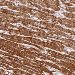 DAP Kinase 1 Antibody, Novus Biologicals 0.1mL; Unlabeled:Antibodies, Polyclonal