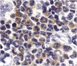 DAP Kinase 2 Antibody, Novus Biologicals 0.1mg; Unlabeled:Antibodies, Polyclonal