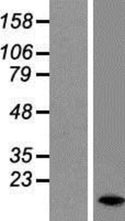 Novus Biologicals&trade;&nbsp;DAP1 Overexpression Lysate