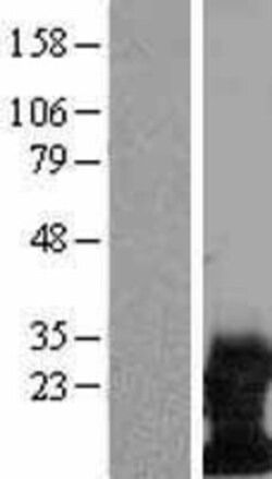 Novus Biologicals&trade;&nbsp;DAP12 Overexpression Lysate