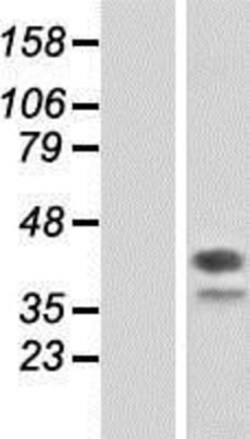 Novus Biologicals&trade;&nbsp;DAP3 Overexpression Lysate