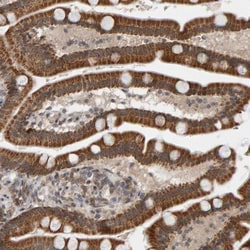 DAP3 Antibody, Novus Biologicals 25 &mu;L; Unlabeled:Antibodies, Polyclonal