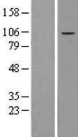 Novus Biologicals&trade;&nbsp;DAP5 Overexpression Lysate