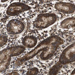 DAP5 Antibody, Novus Biologicals 0.1mL; Unlabeled:Antibodies, Polyclonal