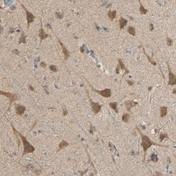 DAP5 Antibody, Novus Biologicals:Antibodies:Primary Antibodies