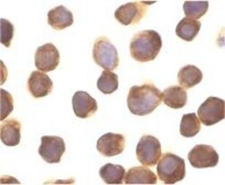 DAPK3/ZIPK Antibody, Novus Biologicals 0.025 mg, Unconjugated:Antibodies,