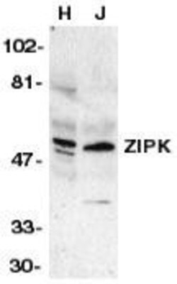 DAPK3/ZIPK Antibody, Novus Biologicals 0.025 mg, Unconjugated:Antibodies,