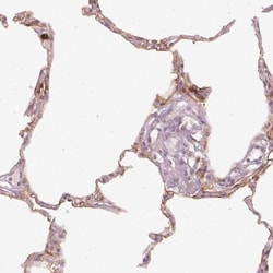 DAPP1 Antibody, Novus Biologicals 25 &mu;L, Unlabeled:Antibodies, Polyclonal
