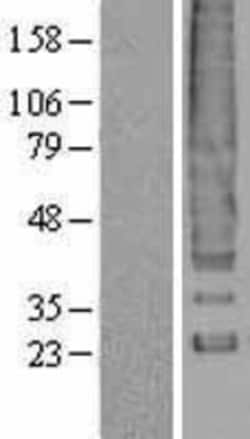 Novus Biologicals™ DARC Overexpression Lysate