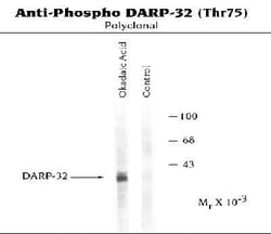 DARPP-32, p Thr75 Antibody, Novus Biologicals 0.1mL; Unlabeled:Antibodies,