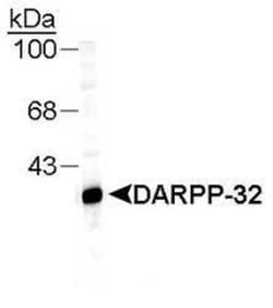 DARPP-32 Antibody, Novus Biologicals 0.1mL; Unlabeled:Antibodies, Polyclonal