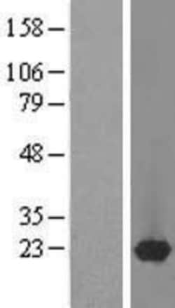 Novus Biologicals&trade;&nbsp;DARPP-32 Overexpression Lysate
