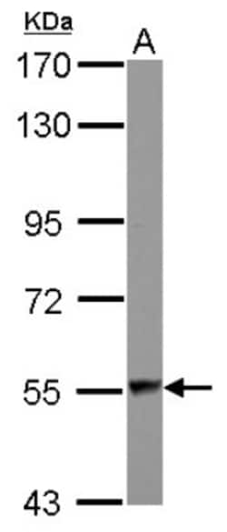 DARS Antibody, Novus Biologicals 0.1mL; Unlabeled:Antibodies, Polyclonal