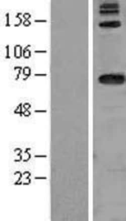Novus Biologicals&trade;&nbsp;DARS2 Overexpression Lysate