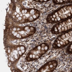 DARS2 Antibody, Novus Biologicals 25 &mu;L; Unlabeled:Antibodies, Polyclonal