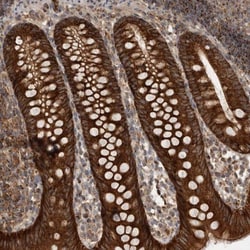 DARS2 Antibody, Novus Biologicals:Antibodies:Primary Antibodies