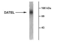 SLC6A3/DAT1 Antibody, Novus Biologicals 0.1mL; Unlabeled:Antibodies, Polyclonal