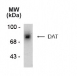SLC6A3/DAT1 Antibody, Novus Biologicals 0.1mL; Unlabeled:Antibodies, Polyclonal