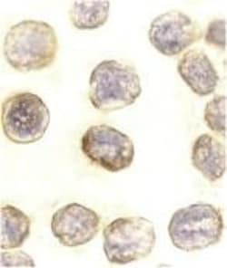 Daxx Antibody, Novus Biologicals 0.025 mg, Unconjugated:Antibodies, Polyclonal