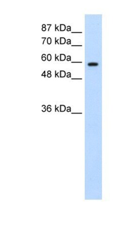 DAZ2 Antibody, Novus Biologicals:Antibodies:Primary Antibodies