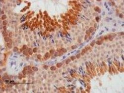 DAZL Antibody, Novus Biologicals 0.1mg; Unlabeled:Antibodies, Polyclonal