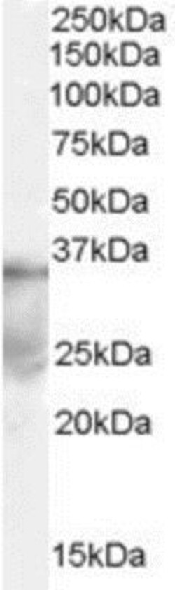 DAZL Antibody, Novus Biologicals 0.1mg; Unlabeled:Antibodies, Polyclonal