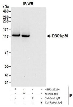 DBC1/p30 Antibody, Novus Biologicals 0.1mg; Unlabeled:Antibodies, Polyclonal