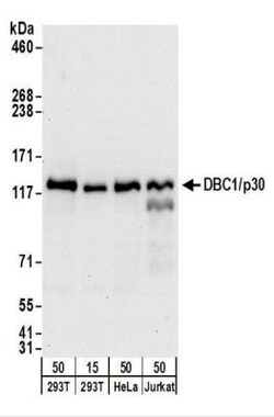 DBC1/p30 Antibody, Novus Biologicals 0.1mg; Unlabeled:Antibodies, Polyclonal