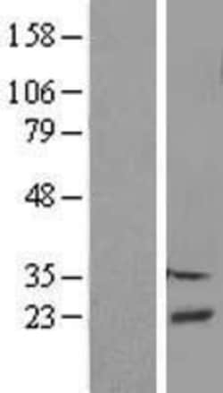 Novus Biologicals&trade;&nbsp;DBNDD2 Overexpression Lysate