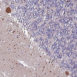 DBNDD2 Antibody, Novus Biologicals 25 &mu;L | Buy Online | Novus Biologicals | Fisher Scientific