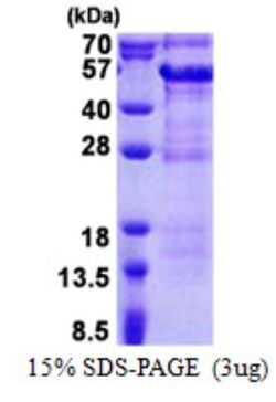 Novus Biologicals&trade;&nbsp;Recombinant Human DBR1 His Protein