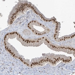 DBR1 Antibody, Novus Biologicals 0.1mL; Unlabeled:Antibodies, Polyclonal