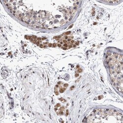 DBT Antibody, Novus Biologicals:Antibodies:Primary Antibodies