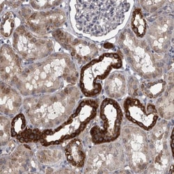 DBT Antibody, Novus Biologicals:Antibodies:Primary Antibodies
