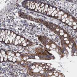 DBT Antibody, Novus Biologicals 0.1mL; Unlabeled:Antibodies, Polyclonal