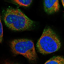 DBX1 Antibody, Novus Biologicals 0.1mL; Unlabeled:Antibodies, Polyclonal
