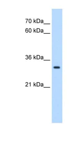 DBX2 Antibody, Novus Biologicals 100&mu;L; Unlabeled:Antibodies, Polyclonal