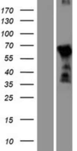 Novus Biologicals&trade;&nbsp;DBX2 Overexpression Lysate