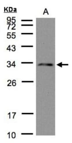 anti-DC8, Polyclonal, Novus Biologicals 0.1mg; Unlabeled:Antibodies, Polyclonal