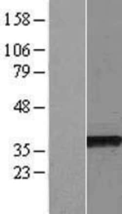 Novus Biologicals™ DC8 Overexpression Lysate