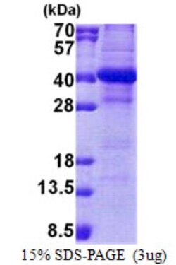 Novus Biologicals&trade;&nbsp;Recombinant Human DC8 His Protein