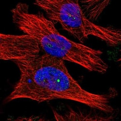 DCAF10 Antibody, Novus Biologicals 0.1mL; Unlabeled:Antibodies, Polyclonal