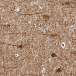 DCAF10 Antibody, Novus Biologicals 0.1mL; Unlabeled:Antibodies, Polyclonal