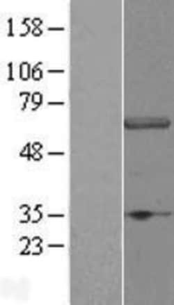 Novus Biologicals&trade;&nbsp;DCAF11 Overexpression Lysate
