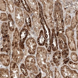 DCAF11 Antibody, Novus Biologicals 25 &mu;L; Unlabeled:Antibodies, Polyclonal
