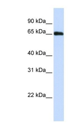 DCAF11 Antibody, Novus Biologicals 100 &mu;L | Buy Online | Novus Biologicals | Fisher Scientific