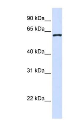 DCAF12 Antibody, Novus Biologicals:Antibodies:Primary Antibodies