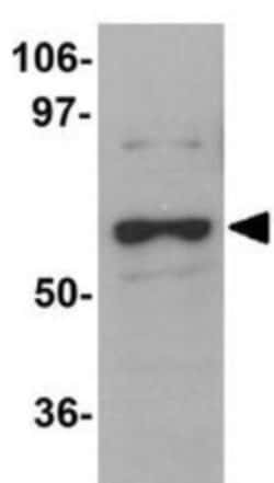 DCAF12 Antibody - BSA Free, Novus Biologicals 0.1mg; Unlabeled:Antibodies,