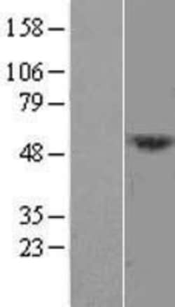 Novus Biologicals&trade;&nbsp;DCAF12L1 Overexpression Lysate