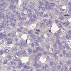 DCAF12L2 Antibody, Novus Biologicals 25 &mu;L, Unlabeled:Antibodies, Polyclonal